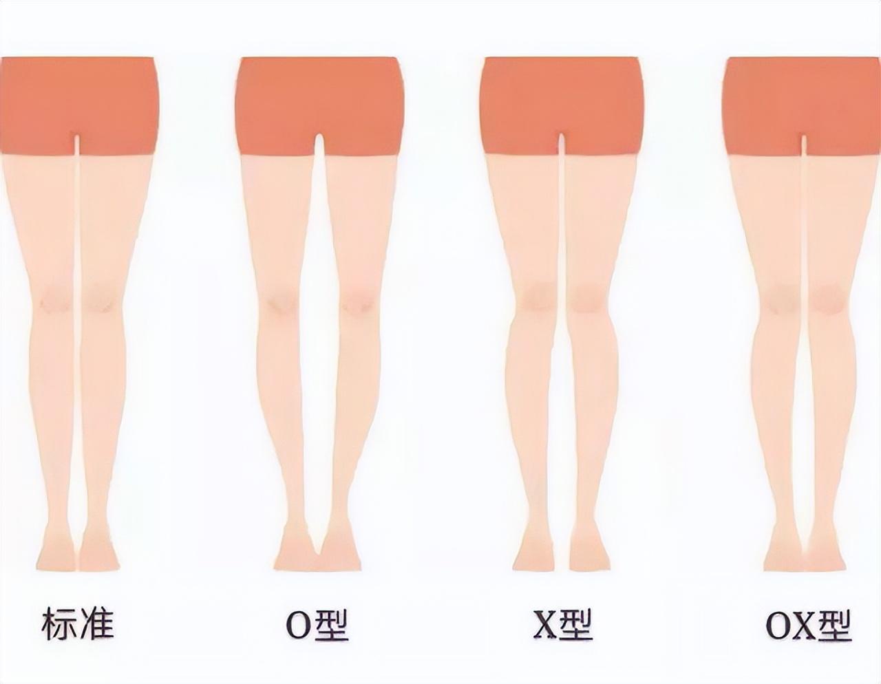 中年女人，可以不穿长裤、长裙！但这3种短裤必不可少，洋气显瘦 图1